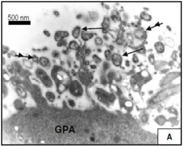 Le phytoplasme responsable de la flavescence doree